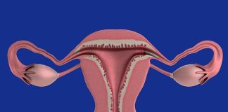 Ce qu’il y a à savoir sur l’endométriose