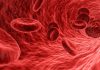 Les causes de l’hypertension artérielle