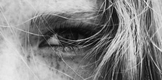 Ce que la peau sèche signifie