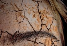 Les astuces pour soigner la peau sèche naturellement